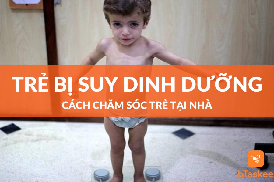 Cách chăm sóc trẻ bị suy dinh dưỡng
